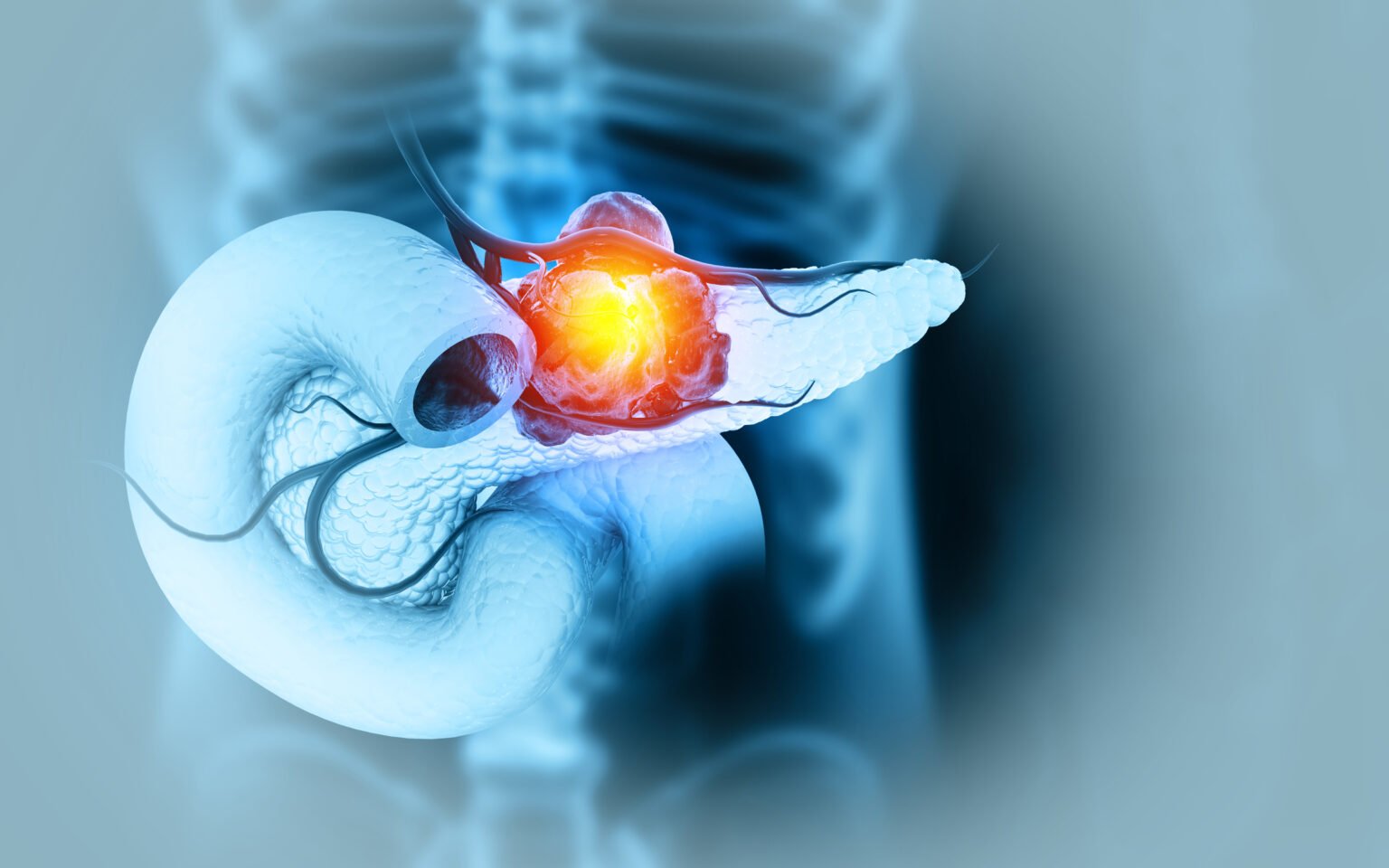 Types of Surgery for Pancreatic Cancer | Birmingham HPB
